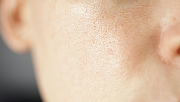 Quelle routine de soins de la peau adopter pour minimiser les pores dilatés?